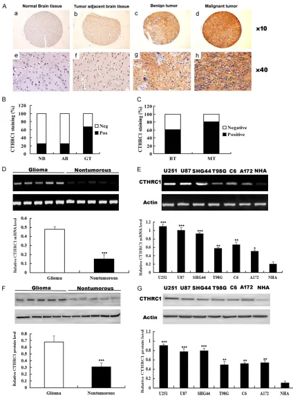 Figure 1. Expression of CTHRC1 in human glioma samples and glioma cell lines. A. Representative images depict CTHRC1 immunohistochemical staining