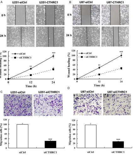 Figure 3. Knockdown of CTHRC1 inhibits glioma cell migration. A, B. Wound-healing assay was done on monolayers of U251 and U87 glioma cells after 36 hours of transfection