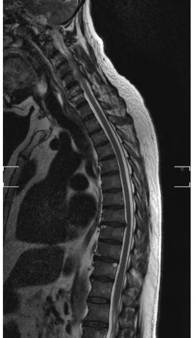 Figure 1. Patient cervical radiography.                          