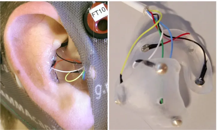 Figure 1: An image of ear-EEG inside and outside the ear
