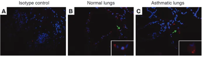 Figure 1TLR6 expression in asthmatic lungs. TLR6 expression (red) was evaluated using immunofluorescence 