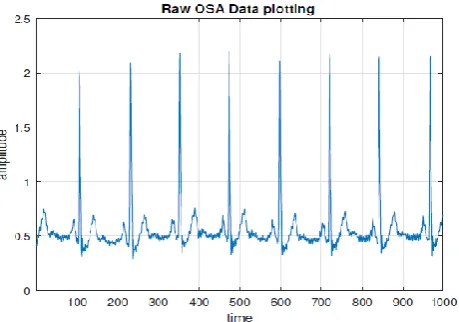 Fig. 2. ECG-Apnea database Obstructive Sleep Apnea Signal 