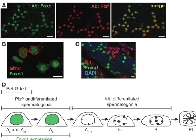 Figure 4Foxo1 is specifically expressed in undif-