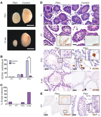Figure 5Regulation of Foxo1 by the PI3K-Akt path-