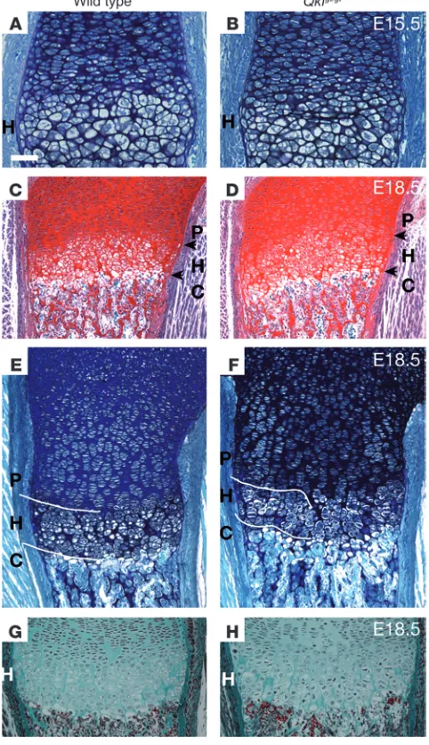 Figure 5Myst4 deficiency alters growth plate in mice. (Disorganization in the visible at E15.5 and (Gthe poor demarcation between the phic, and chondrolytic (C) regions, as compared with those of wild-type regions, particularly in reduced height of the hyp