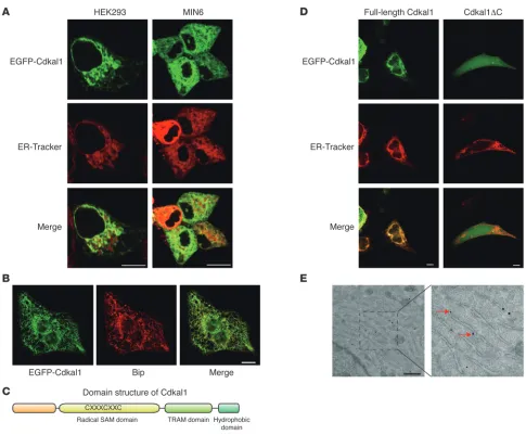 Figure 2Cdkal1 localizes on ER through its hydrophobic domain. (A) Colocalization of overexpressed Cdkal1-EGFP (green) and ER-tracker (red) on ER in HEK293 cells and MIN6 cell