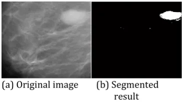 Figure 4. Example of segmentation results by the Global thresholding. 
