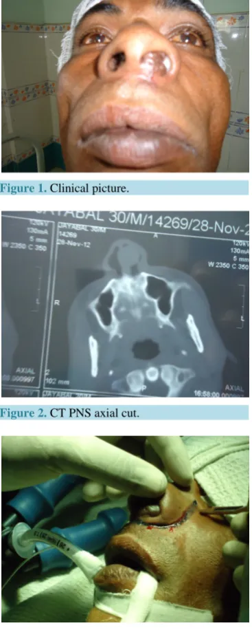 Figure 1. Clinical picture.                             