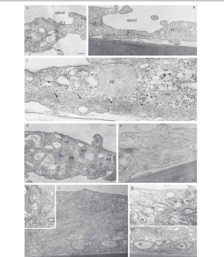 Figure 1 LPS exposure causes an activated/dysfunctional ECs phenotype (I). ECs exposed to 1 μg/ml LPS for 48 h show open IEJs, (a, b), increased accumulation of actin filaments at cell periphery (c, arrows), significant increase in the number of Weibel-Pal