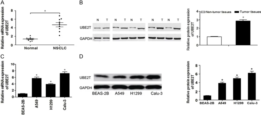 Figure 1. UBE2T is upregulated in NSCLC tissues and cell lines. A. The relative expression of UBE2T in NSCLC tis-sues and adjacent non-cancer tissues was determined by qRT-PCR