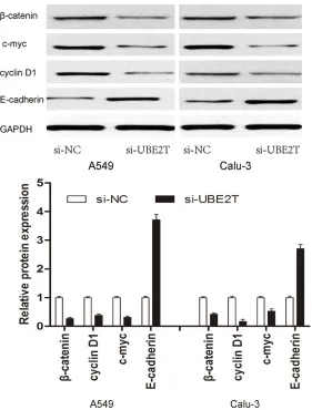 Figure 4. UBE2T promotes the activity of Wnt/β-catenin signaling pathway. Western blot assays were used to detect the protein levels of β-catenin, c-myc, cyclin D1 and E-cadherin, with GAPDH as the control