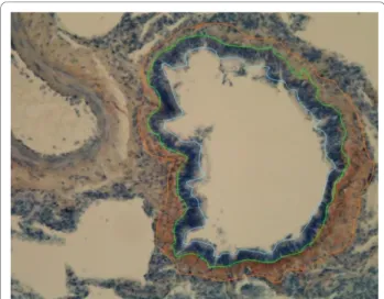 Figure 2 Analysis of small airways by the image analysis method. Measurements: internal perimeter (blue line), basement membrane perimeter (green line) and external perimeter of expression of precursor protein of collagen III (orange line).