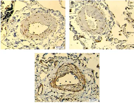 Figure 4A, the expression level of miR-146a was significantly 