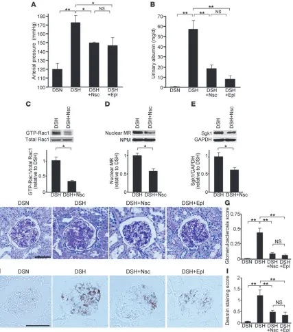 Figure 2Inhibition of Rac1 ameliorates hypertension and renal damage in Dahl-S rats with the repression of MR signaling