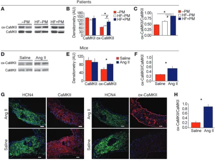 Figure 1ox-CaMKII is increased in heart failure patients and in Ang II–infused mice. (A) Representative immunoblots showing ox-CaMKII and total CaM-KII from right atrial tissue obtained from heart failure patients with SND requiring pacemaker (HF+PM) impla