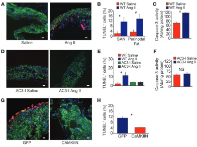 Figure 4Ang II infusion causes SAN cell death and SND. (A) Representative SAN tissue section showing increased TUNEL staining (red) in mice infused 