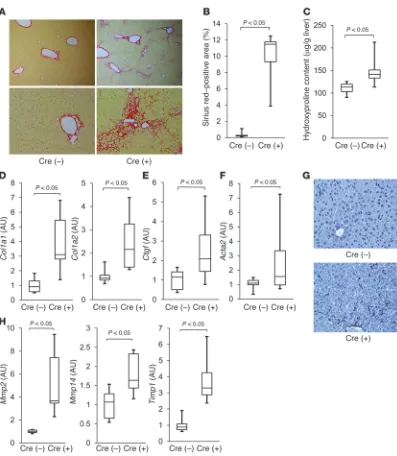 Figure 2Hepatocyte-specific Mdm2-knockout mice develop spontaneous liver fibrosis with an increase in expression of the Ctgf gene