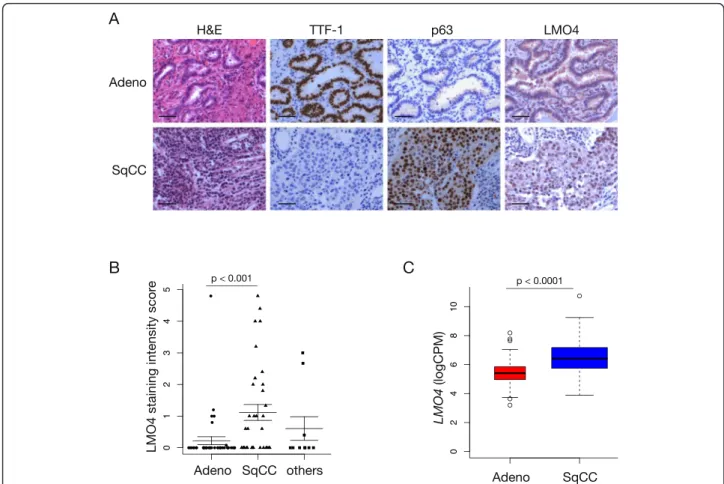 Fig. 6 LMO4 is expressed in early stage lung squamous cell carcinoma. a Representative immunohistochemistry images showing the expression of TTF-1, p63 and LMO4 in human NSCLC cancer tissue microarray (TMA)