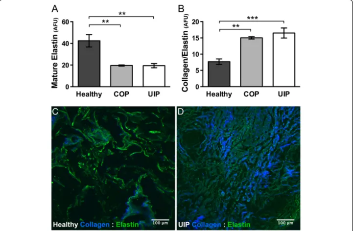 Fig. 6 Elastin content and Collagen:Elastin ratio differ in UIP and COP versus healthy lung