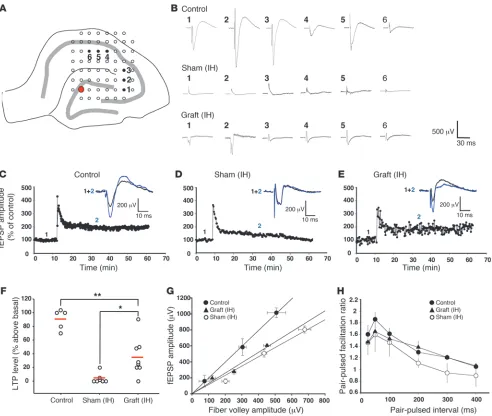 Figure 4Recovery of excitatory synaptic transmission and LTP after human OE-MSC transplantation in lesioned hippocampi