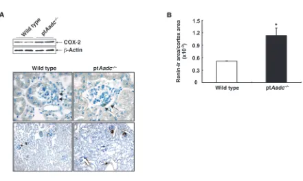 Figure 4Renal cortical COX-2 and renin expression increased in pt
