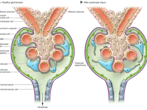 Figure 1Glomerular parietal epithelial cells and the injury response. (A) The glomerular tuft is surrounded by Bowman’s capsule, which is lined by parietal 