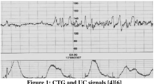 Figure 1: CTG and UC signals [4][6] CTG data analysis through Machine learning approaches 