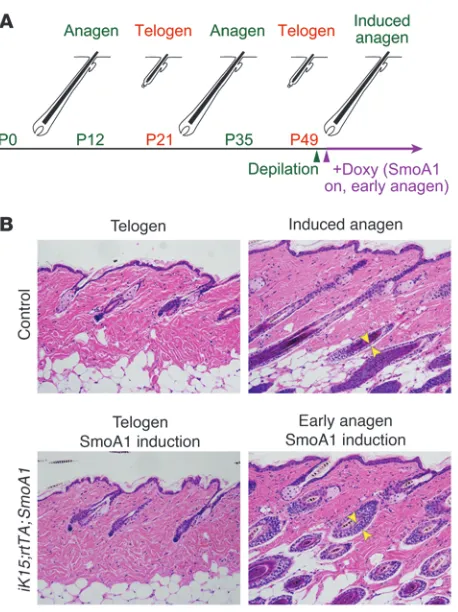 Figure 7Oncogenic Smo drives outer root sheath hyperplasia but not nodu-