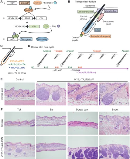 Figure 1BCC-like skin tumors arise from hair follicle stem cells. (A) General scheme showing triple-transgenic model combining Cre-lox and tet/doxy-cycline-regulated technologies to achieve tight spatial and temporal control of transgene expression