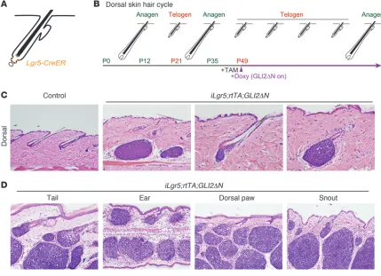 Figure 3Robust BCC-like skin tumor development from the Lgr5+ subset of follicle stem cells