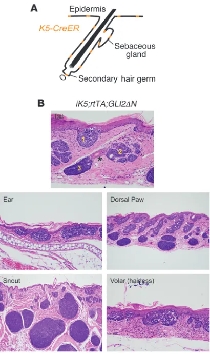 Figure 5Induction of GLI2