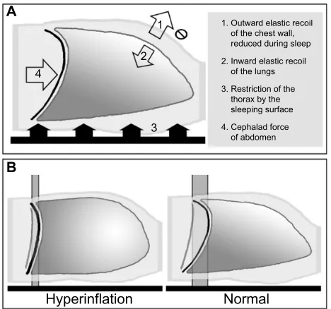 Figure 3 Thoracic physiology during supine sleep.