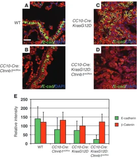 Figure 6Loss of E-cadherin expression in CC10-Cre:KrasG12D:Ctnnb1ex3flox tumor epi-thelium