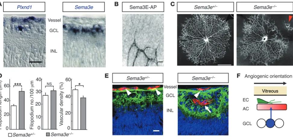 Figure 3Neuron-derived Sema3E restricts vascular pathfinding in developing retinas. (