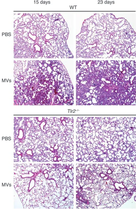 Figure 6TLR2-dependent inflammation in mouse lungs after vesicle injection. 