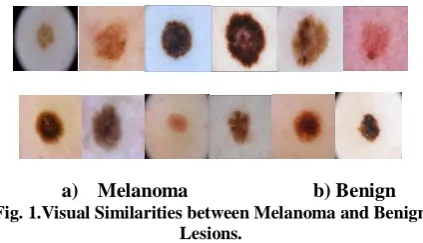 Fig. 1.Visual Similarities between Melanoma and Benign Lesions.  
