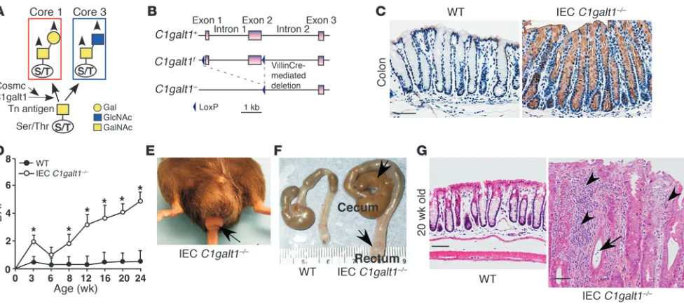 Figure 1IEC C1galt1–/– mice develop spontaneous colitis. (A) Scheme for the biosynthesis of core 1 and core 3 O-glycans