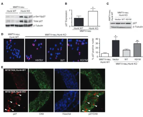 Figure 8Hunk negatively regulates p27 expression and localization in vivo. (A) Western blot analysis of p27 and phospho–serine 10 in MMTV-neu;Hunk–wild-type and MMTV-neu;Hunk–deficient tumor samples