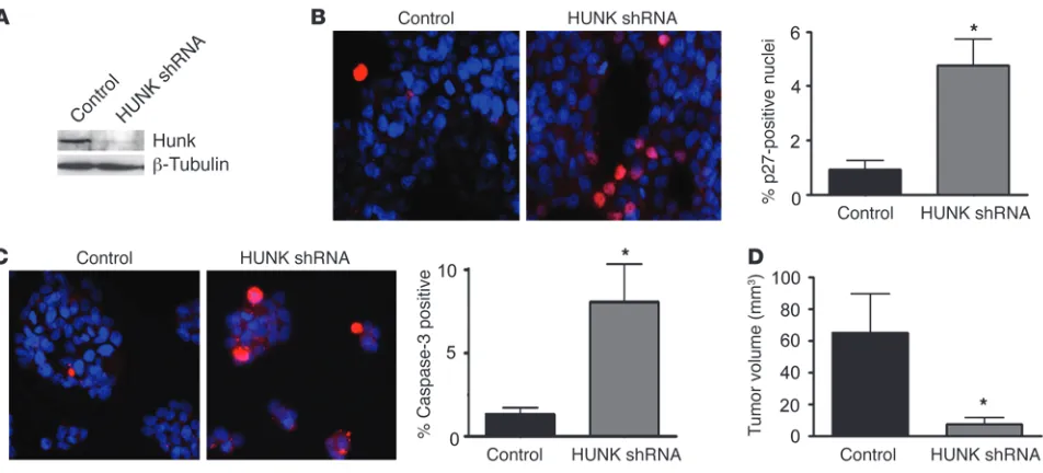 Figure 9Hunk inhibits tumor formation of human breast cancer cells by modulating p27 localization and cell survival