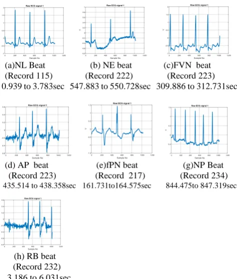 Fig. 3(a)-(g). ECG signals of different classes 