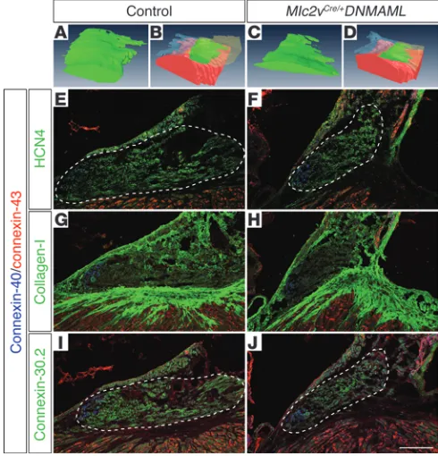 Figure 1Loss of Notch signaling results in a smaller AV node and alteration of 