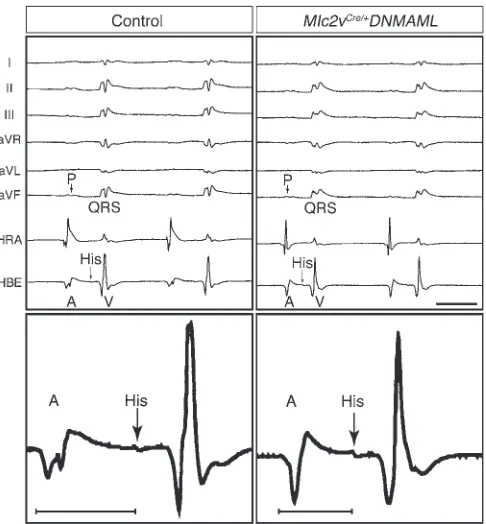 Figure 2Notch inhibition disrupts AV nodal delay. The top panels show repre-