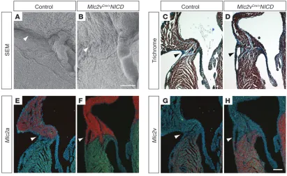 Figure 3Activation of Notch signaling results in accessory pathway formation. (