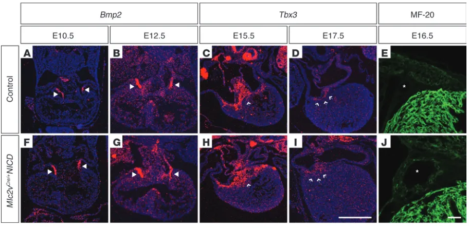 Figure 4Developmental analysis reveals late gestation AV canal defects in 