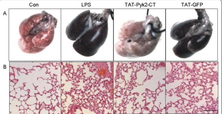 Figure 2 Effect of Pyk2 inhibition on lung gross anatomy (A) and histology (B) of LPS-challenged mice
