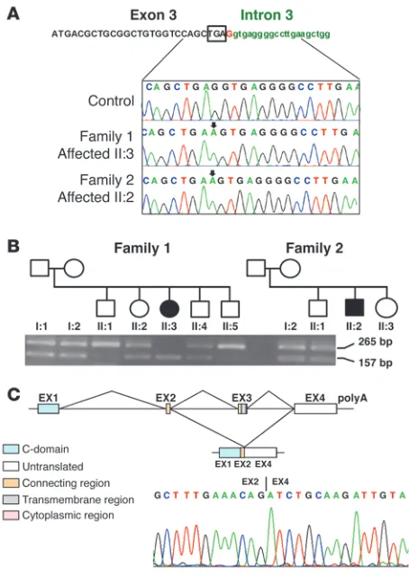 Figure 3Identification of a homozygous G-to-A substitution in the first base fol-