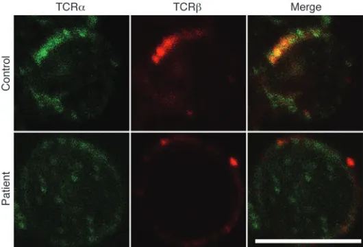 Figure 5TRAC mutation results in mislocalization of the TCR
