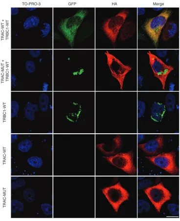 Figure 6Cellular localization of TCR