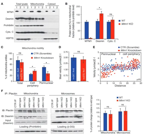 Figure 8The MTM1-desmin complex is associated with mitochondria and is involved in mitochondrial dynamics/motility