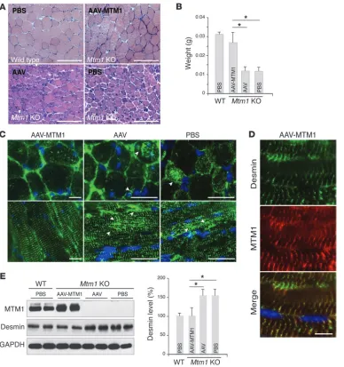 Figure 4Ectopic expression of MTM1 